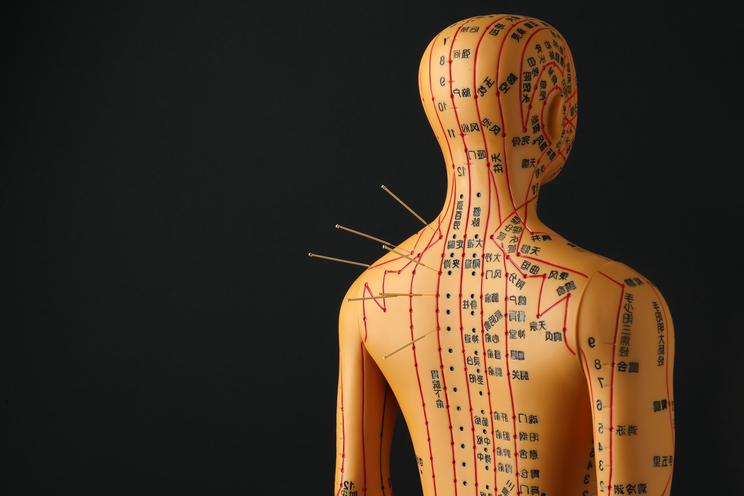 Acupuncture treatment